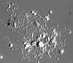 Mouse megakaryocyte forming proplatelets